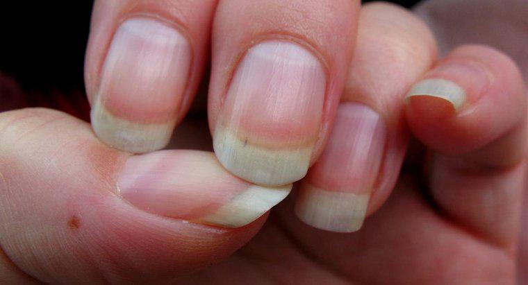 Was verursacht Rillen in Fingernägeln?