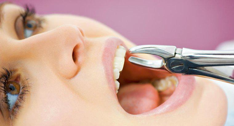 Wie lange dauert es, bis eine Pfanne verheilt ist, nachdem ein Zahn gezogen wurde?