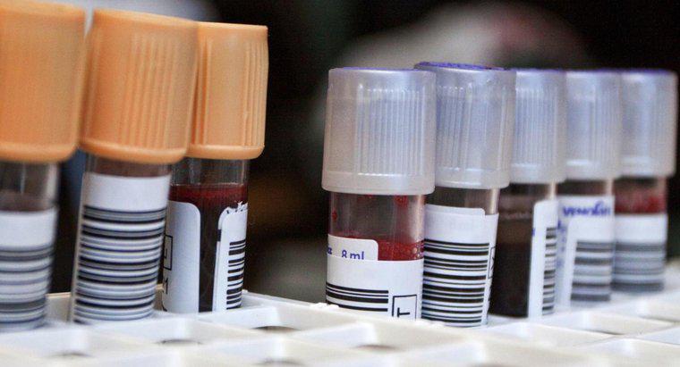 Was ist ein Neutrophilen-Bluttest?