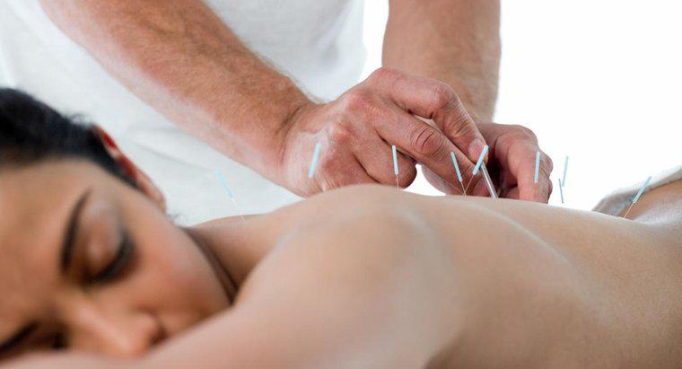 Was sind die durchschnittlichen Kosten für Akupunktur?