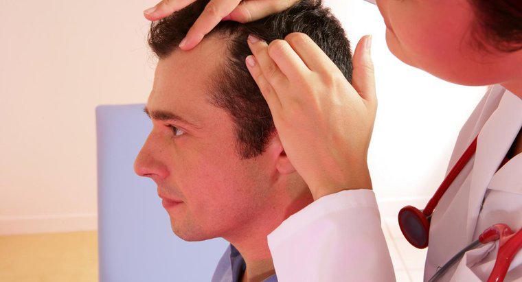 Welcher Arzt behandelt Haarausfall?