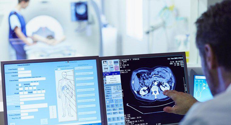 Wie lange dauert es, bis Sie CT-Scan-Ergebnisse erhalten?
