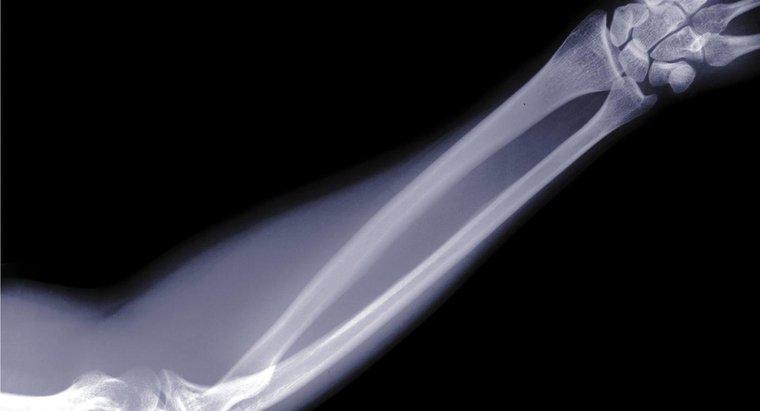 Wie heißen die Knochen im menschlichen Arm?