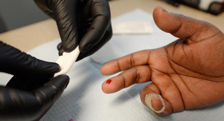 Wie lange dauert es, bis HIV bei Tests auftaucht?