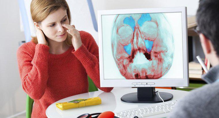 Was sind die Symptome einer Nasennebenhöhlenentzündung?