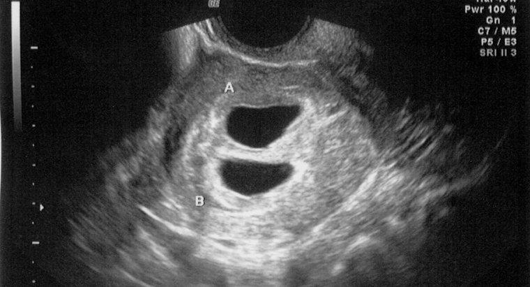 Kann ein Ultraschall eine Schwangerschaft nach 4 Wochen erkennen?