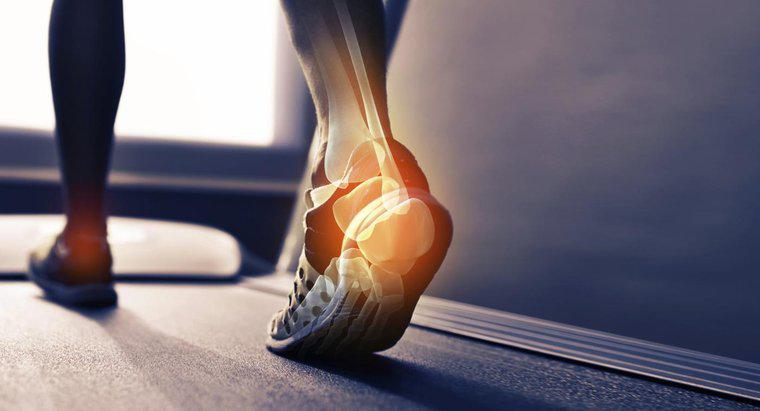 Was verursacht einen Knochensporn an der Ferse Ihres Fußes?
