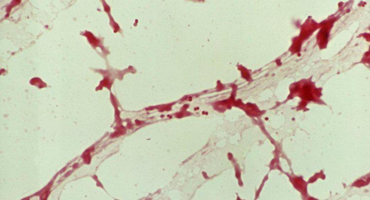 Was sind die Ursachen einer spinalen Meningitis?
