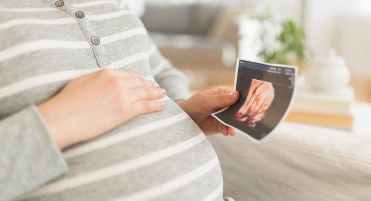 Wie entstehen Fingerabdrücke im Mutterleib?