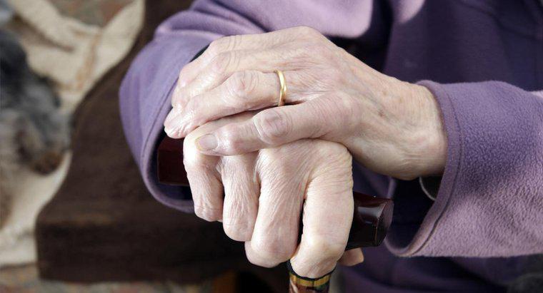 Wie wird Arthritis in den Händen diagnostiziert?
