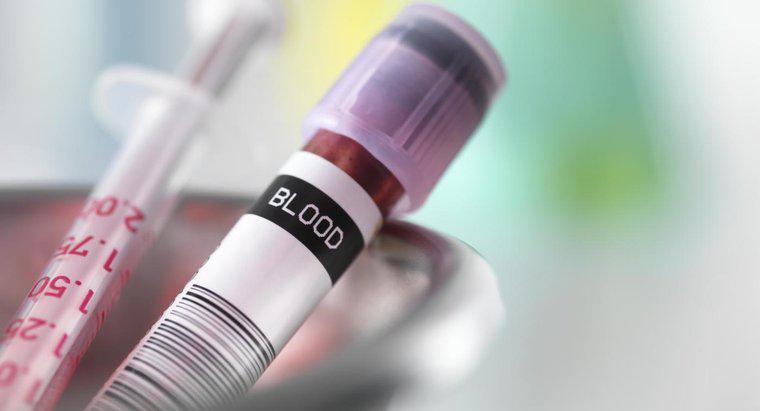Wie diagnostizieren Ärzte die Ursache einer niedrigen Hämoglobinzahl?