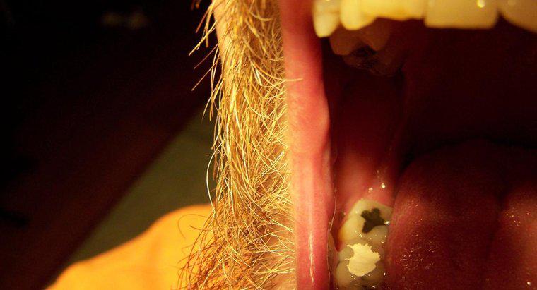 Wie macht man eine hausgemachte Zahnfüllung?