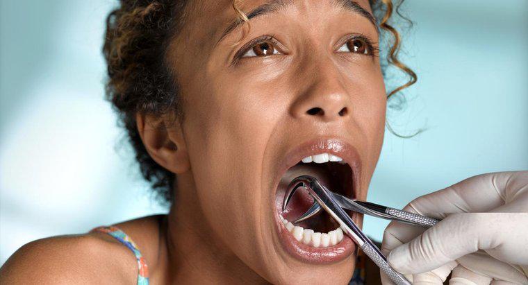 Wie behandelt man eine Infektion nach einer Zahnextraktion?