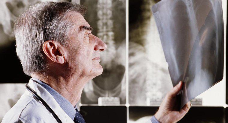 Was sind die Nachteile von Röntgenstrahlen?
