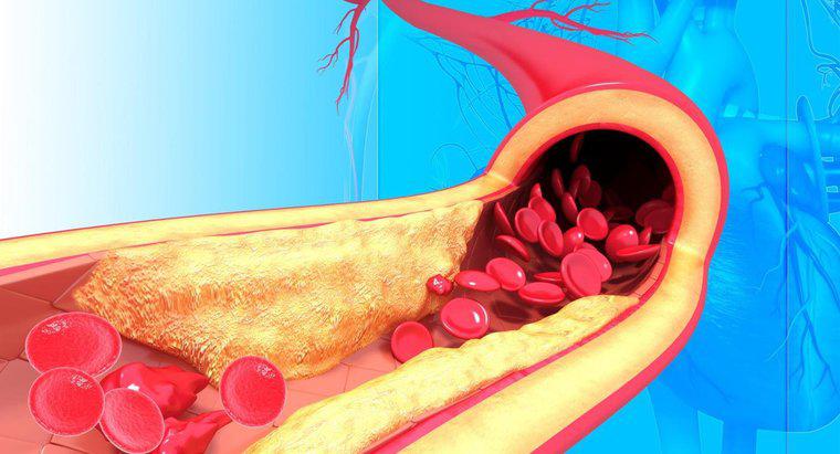 Wie ist der Aufbau von Arterien?