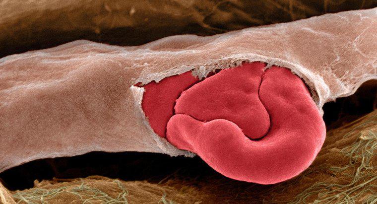 Was verursacht das Brechen von Blutgefäßen?