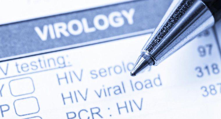 Wie bekommt man HIV?