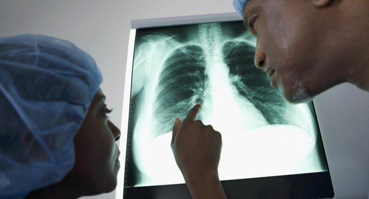 Was sind verschiedene Behandlungsmöglichkeiten für Flüssigkeit in der Lunge?