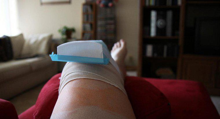 Was ist die Erholungszeit für eine Kniegelenkersatzoperation?