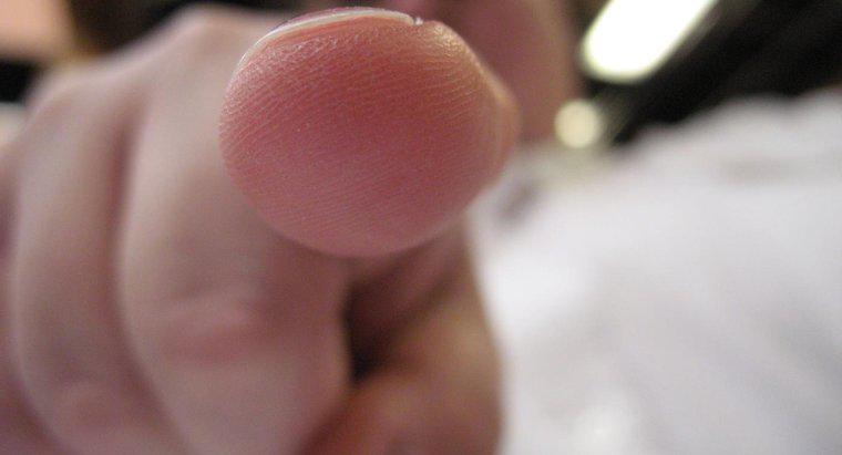 Was ist das häufigste Fingerabdruckmuster?