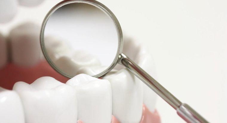 Wie pflegen Sie den Zahnschmelz?