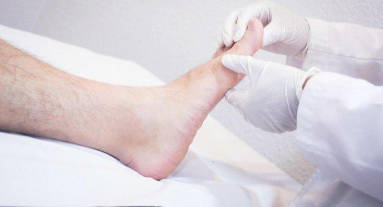 Welche Gesundheitsrisiken sind mit geschwollenen Füßen verbunden?
