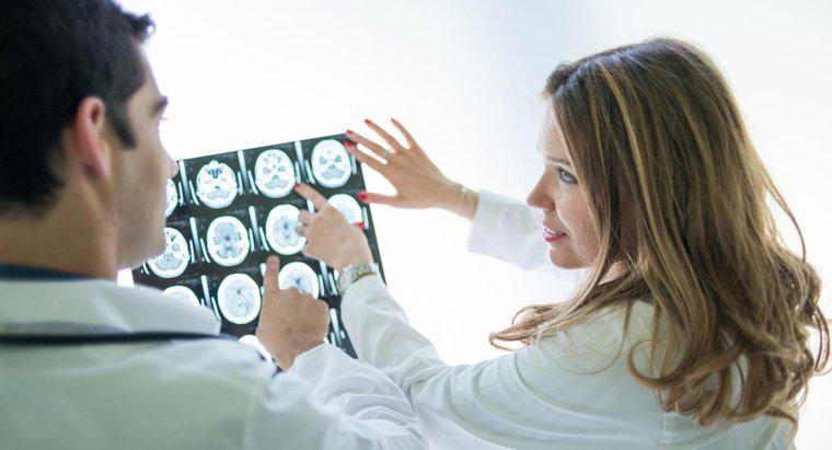 Was sind einige Symptome eines Hirntumors?