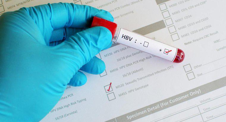 Was bedeutet ein positives Ergebnis bei einem Hepatitis-B-Kerntest?