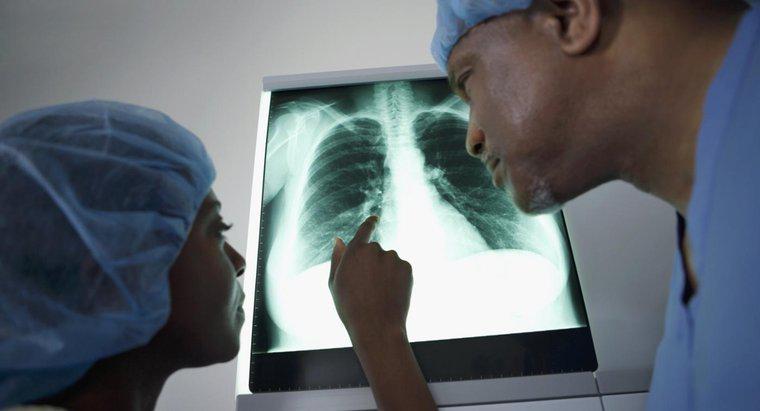 Was bedeutet eine Masse an der Lunge?