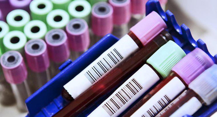 Was sind gängige Abkürzungen bei einem Bluttest?