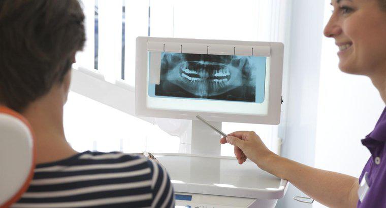 Was sind Vor- und Nachteile von Mini-Zahnimplantaten?
