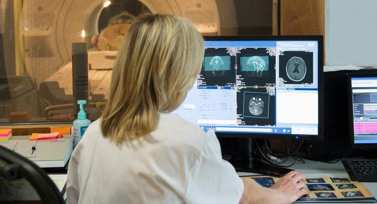 Was bedeutet ein weißer Fleck bei einer MRT des Gehirns?