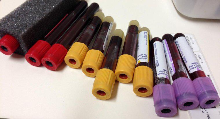 Was misst der Ferritinspiegel in einem Bluttest?