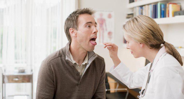 Was bedeuten geschwollene Drüsen unter der Zunge?