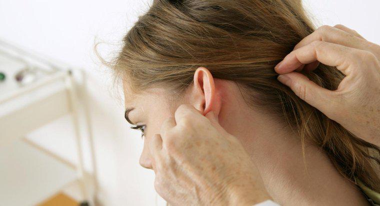 Was sind die Symptome von Kopfhautpilz?