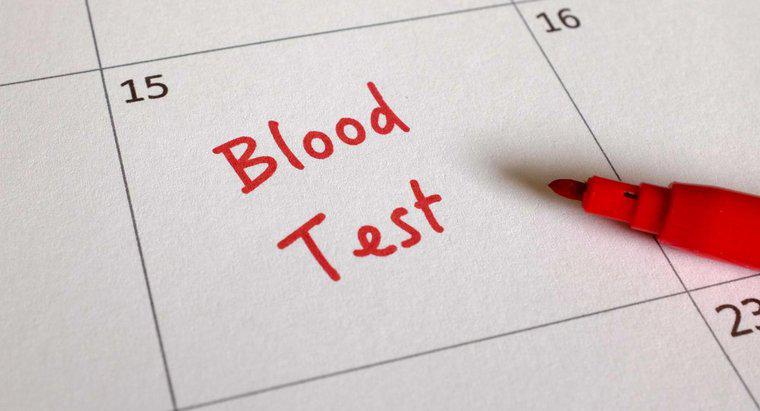 Was ist ein CA 125-Bluttest?