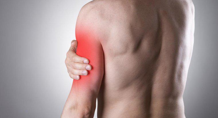 Kann ein eingeklemmter Nerv stechende Schmerzen im linken Arm verursachen?