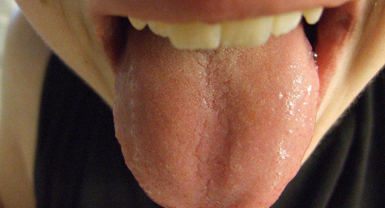 Wie sieht eine normale Zunge aus?