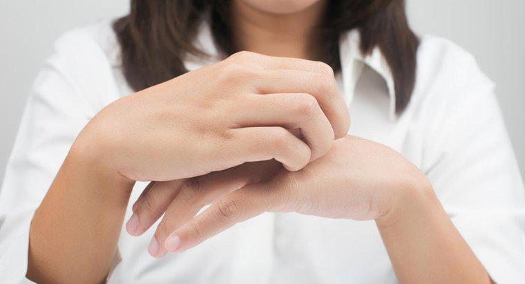 Was verursacht einen juckenden Hautausschlag an Händen und Füßen?