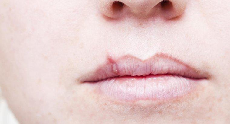 Was ist das erste Anzeichen von Lippenkrebs?