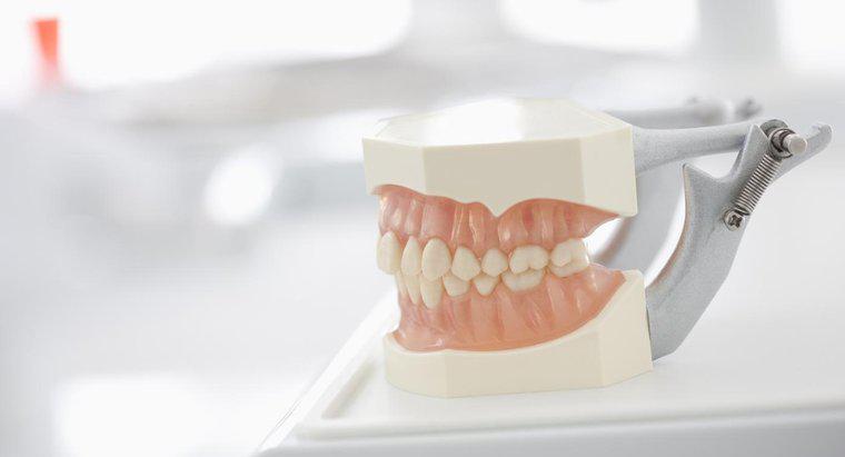 Können Sie Superkleber verwenden, um Zahnersatz zu reparieren?