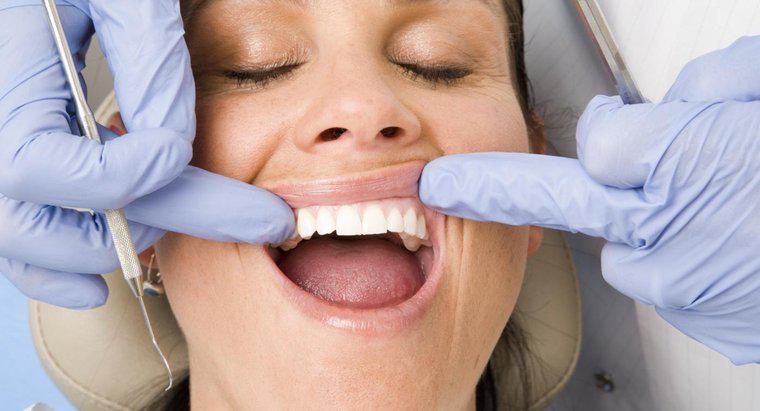 Was führt dazu, dass Ihr Zahnfleisch gereizt und juckt?
