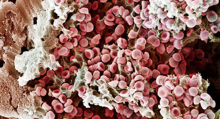 Was verursacht ein geplatztes Blutgefäß?