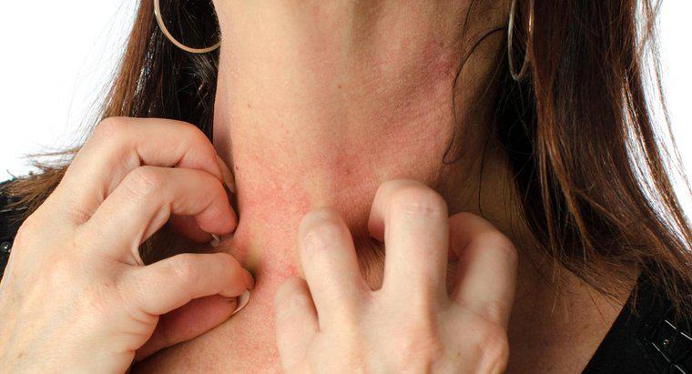 Was sind einige mögliche Ursachen für einen Hautausschlag um Hals und Brust?