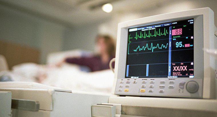 Wie lesen Sie EKG-Übungsteststreifen?