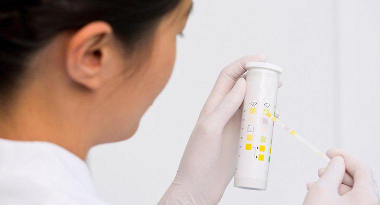 Wozu dient ein Diabetes-Urin-Mikroalbumin-Test?