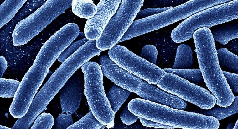 Wie unterscheiden sich Eubakterien und Archaebakterien?