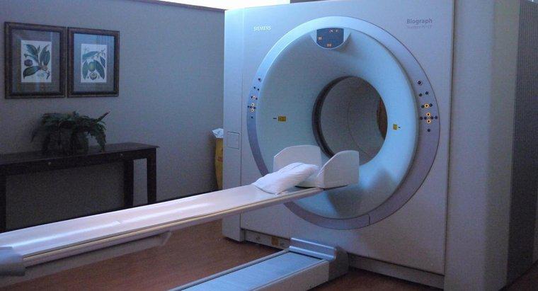 Was zeigt ein CT-Scan?