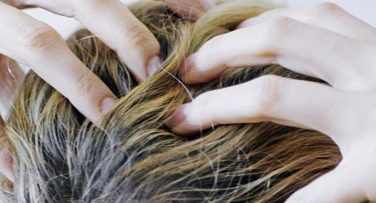 Was verursacht juckende Kopfhaut und Haarausfall?