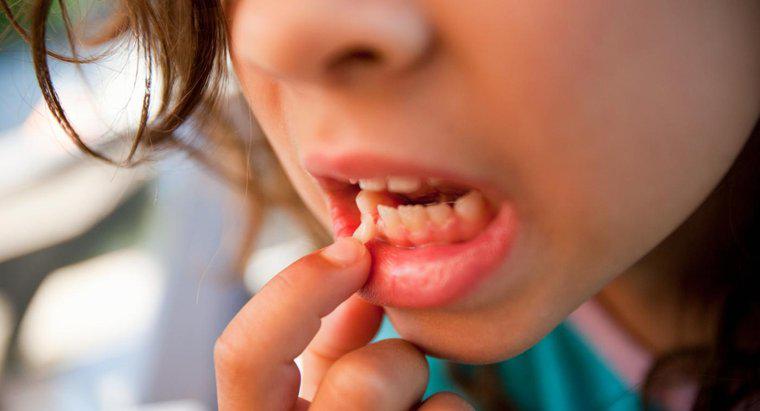 Was verursacht lockere Zähne bei Erwachsenen?